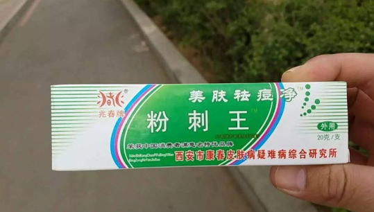 兆春牌粉刺王美肤祛痘净