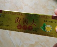 黄铍夫湿痒王抑菌霜的真伪？