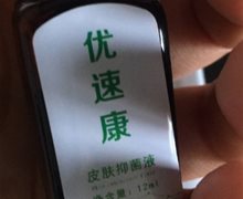 优速康皮肤抑菌液能治尖锐湿疣吗？