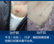 芭院长疤痕修复连锁机构可以做疤痕疙瘩吗？