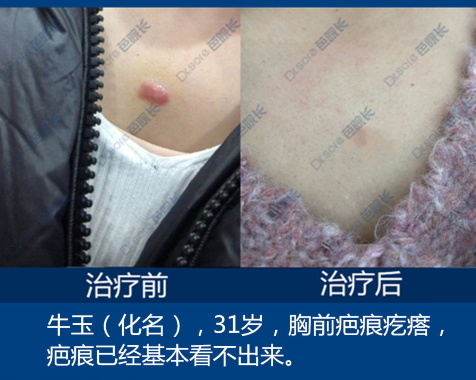 芭院长疤痕修复连锁机构