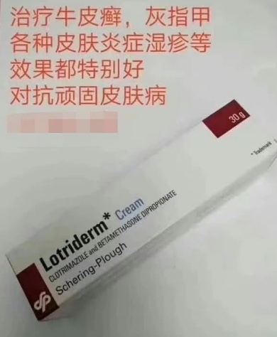 Lotriderm Cream