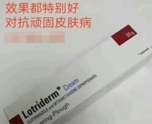 Lotriderm Cream是真的吗？