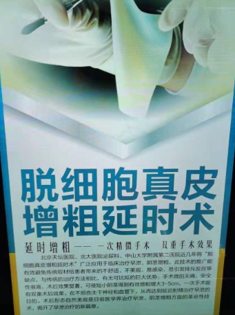 朝阳市泌尿医院脱细胞真皮增粗延时术