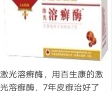 百生康激光溶癣酶是真的吗？