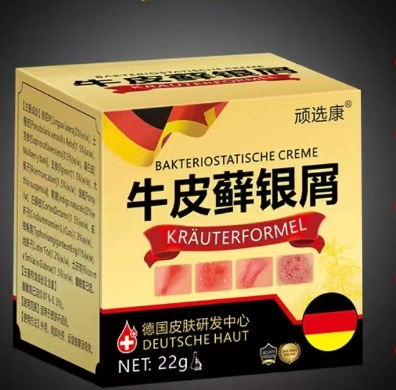 顽选康牛皮癣银屑膏