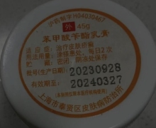 苯甲酸乳膏哪里有买？苯甲酸苄酯乳膏
