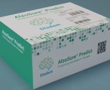 AlzoSure Predict哪里有买？
