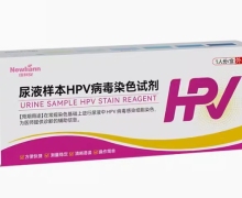 纽利安尿液样本HPV病毒染色试剂价格对比