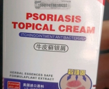 铍特舒PSORIASIS TOPICAL CREAM是真的吗？