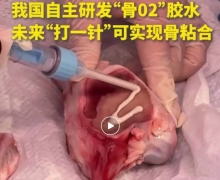 骨02胶水是真的吗？