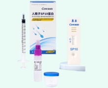 库尔人精子SP10蛋白检测试剂盒价格对比 卡型